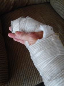 hand bandages